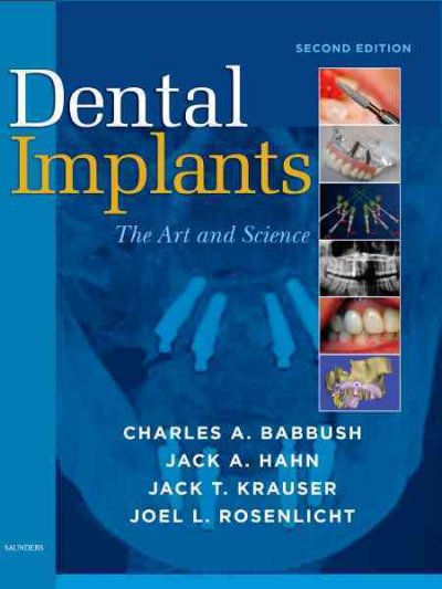 Dental implants : the art and science.