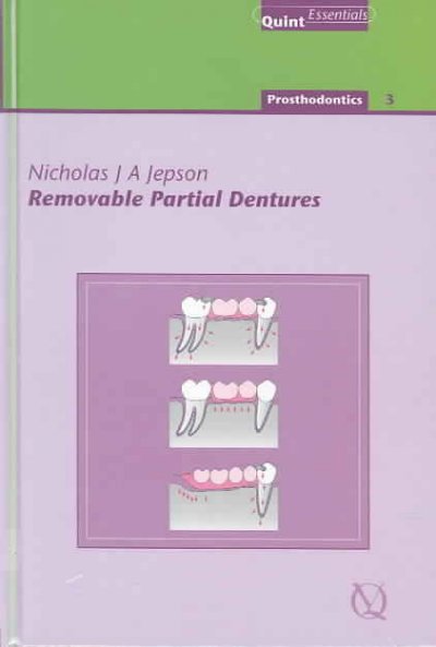 Removable partial dentures / by Nicholas J. A. Jepson ; editor-in-chief, Nairn H.F. Wilson ; editor prosthodontics, P. Finbarr Allen.