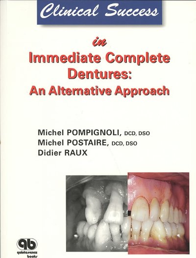 Clinical success in immediate complete dentures : an alternative approach / Michel Pompignoli, Michel Postaire, Didier Raux ; [English translation by Jay K. Weiss].