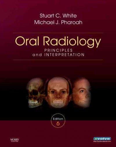 Oral radiology : principles and interpretation.