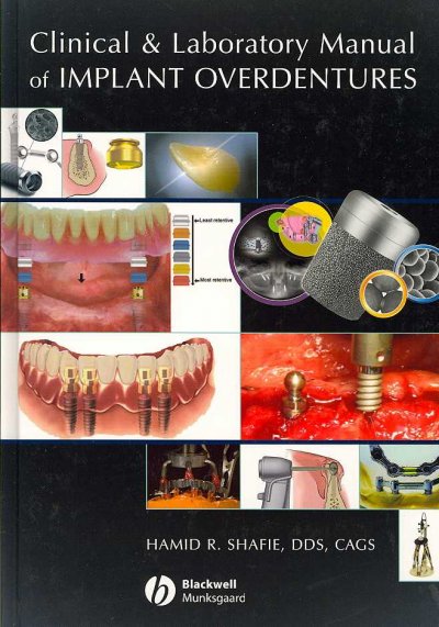 Clinical and laboratory manual of implant overdentures / Hamid R. Shafie.