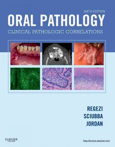 Oral pathology : clinical pathologic correlations.