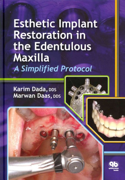 Esthetic implant restoration in the edentulous maxilla : a simplified protocol / Karim Dada, Marwan Daas with collaboration by Paulo Malo.