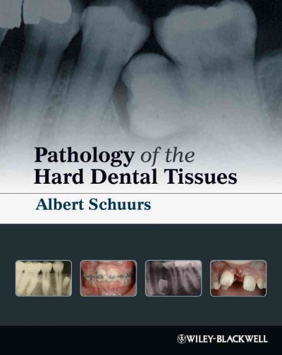 Pathology of the hard dental tissues / Albert Schuurs ; with contributions from Tommy Matos.