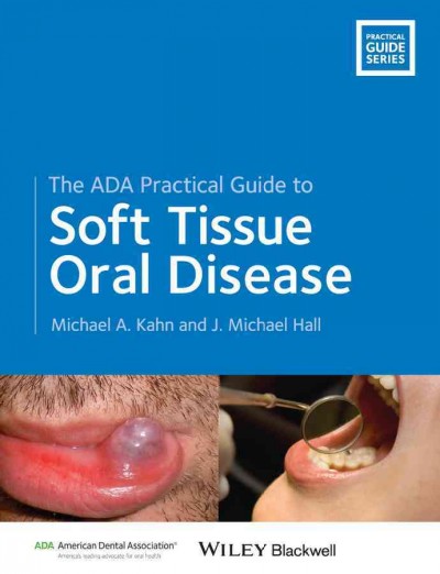 The ADA practical guide to soft tissue oral disease / Michael A. Kahn, J. Michael Hall.