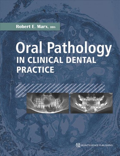 Oral pathology in clinical dental practice / Robert E. Marx.