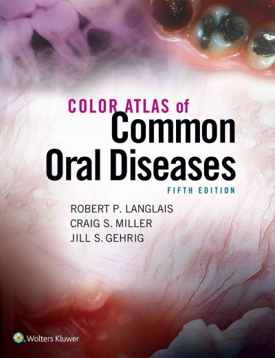 Color atlas of common oral diseases / Robert P. Langlais, BA, DDS, MS, PHD, FRCD(C), Craig S. Miller, DMD, MS, FACD, Jill S. Gehrig, RDH, MA.
