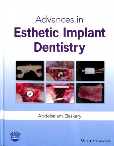 Advances in esthetic implant dentistry / by Dr. Abdelsalam Elaskary.