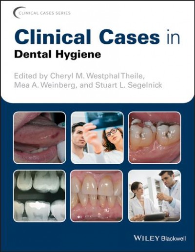 Clinical cases in dental hygiene [electronic resource] / edited by Cheryl M. Westphal Theile, Mea A. Weinberg, Stuart L. Segelnick.