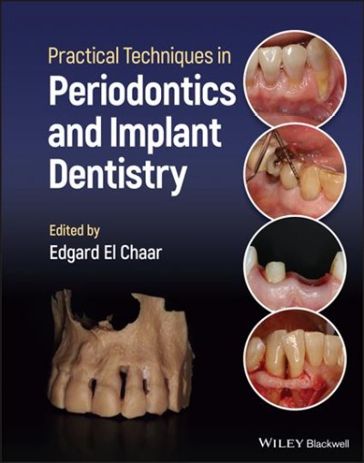 Practical techniques in periodontics and implant dentistry / edited by Edgard El Chaar.