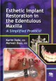 Esthetic implant restoration in the edentulous maxilla : a simplified protocol  Cover Image